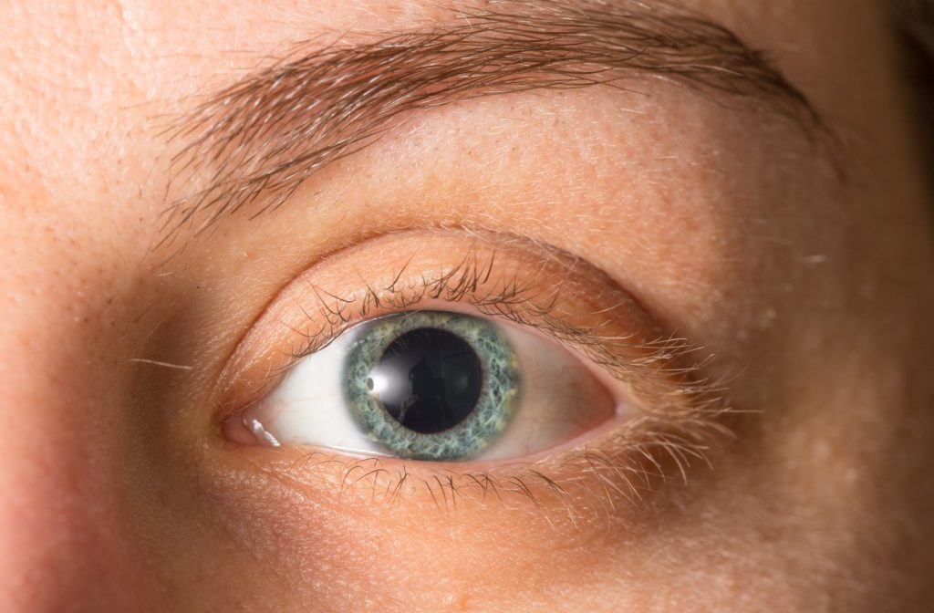 A close up of a man enlarged pupil due to a dilated eye exam